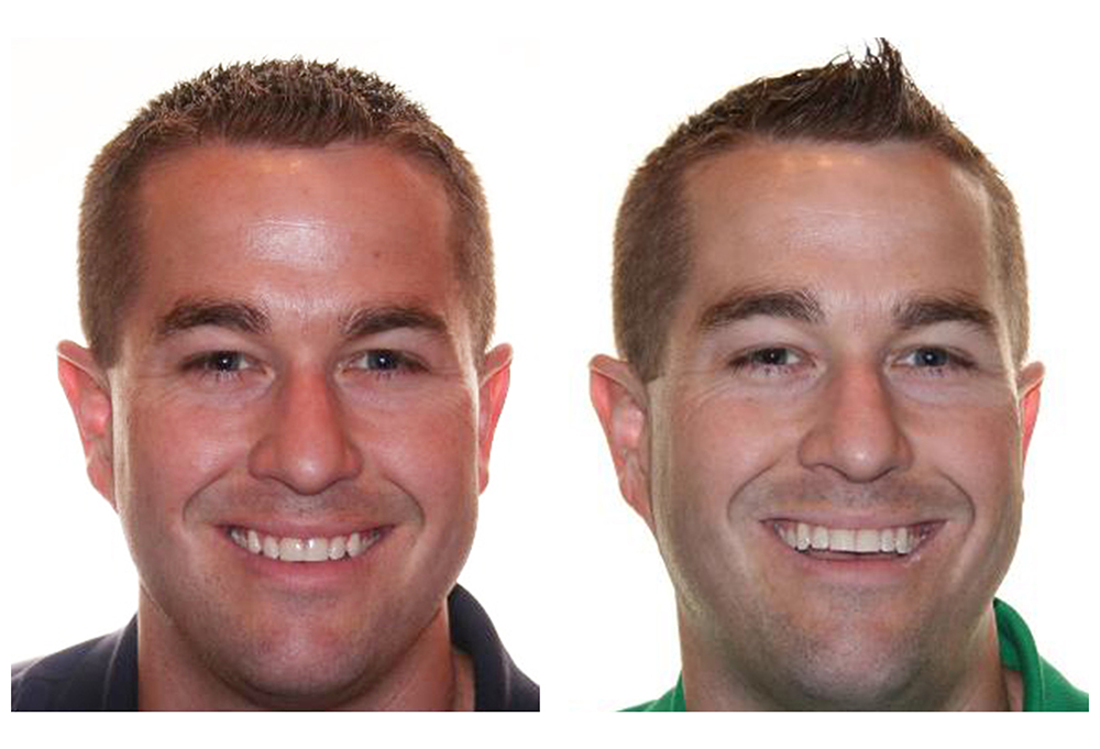 Brilliant Dental of Salem